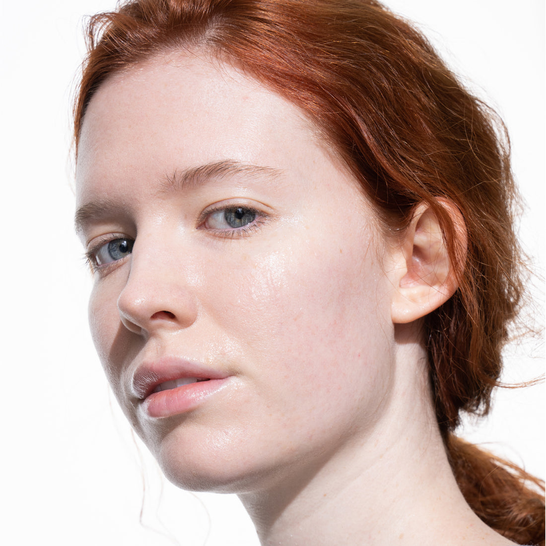 Let's Talk About Rosacea